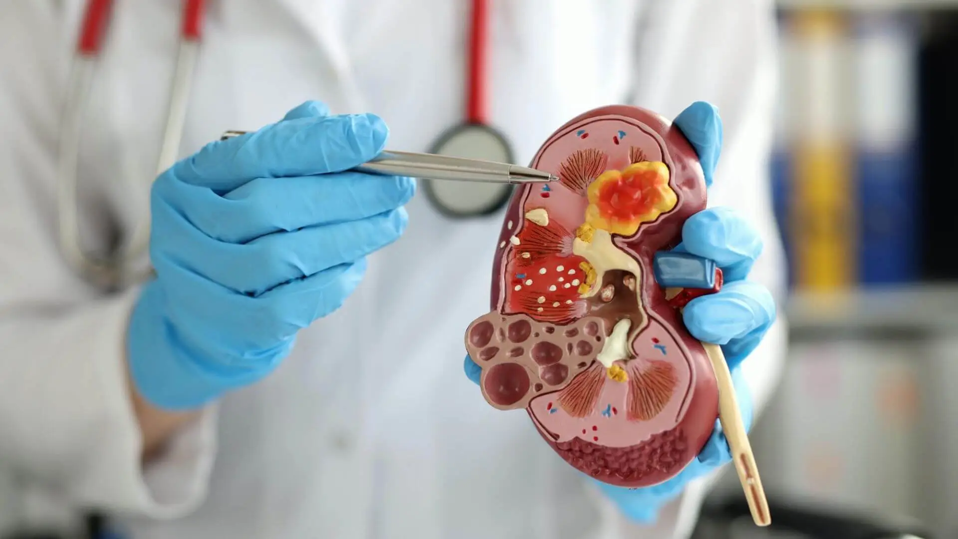 Fegato e reni: quali alimenti aiutano davvero la depurazione del nostro organismo?