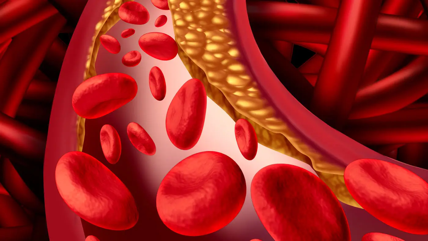 Cattiva circolazione? Piedi e gambe gonfie? Ecco i rimedi naturali per sgonfiarli subito